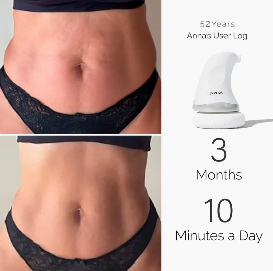 Prouvé BodySculpt 1.0™