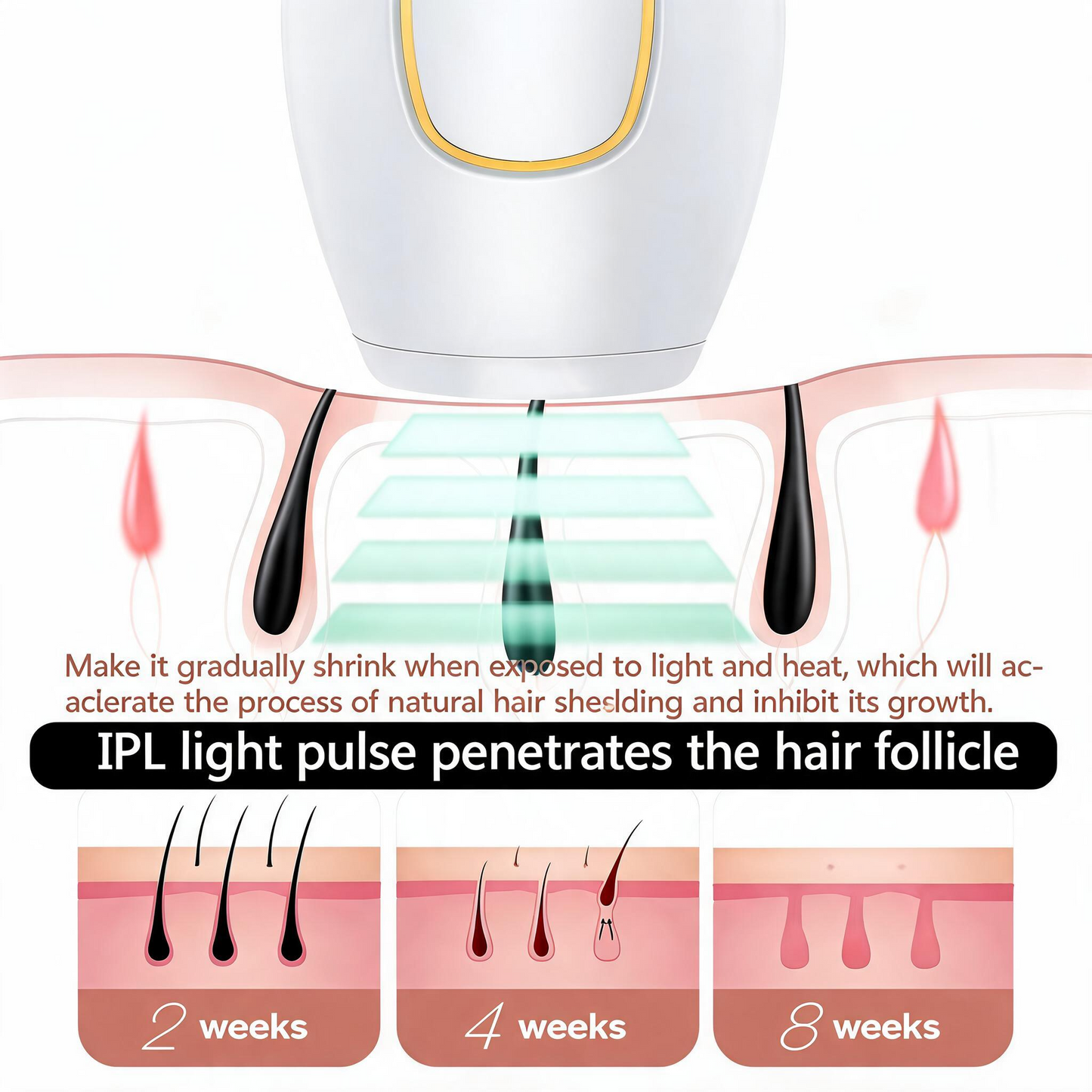 Prouvé IPL Laser™